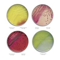 Culture Media Plates