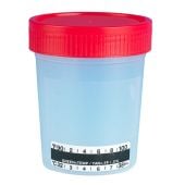 4oz Urine Specimen Containers | Ergonomic Screw Cap | Globe Scientific