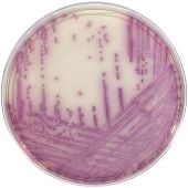 Hardy Diagnostics HardyCHROM Salmonella Plates