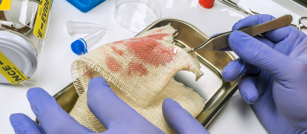 Optimizing Evidence Storage with an Evidence Drying Cabine