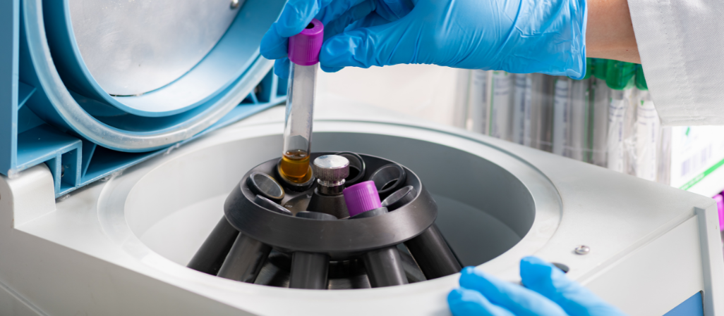 What to Consider Before Purchasing a Centrifuge