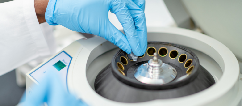 Fixed Angle Rotor Benchtop Centrifuge