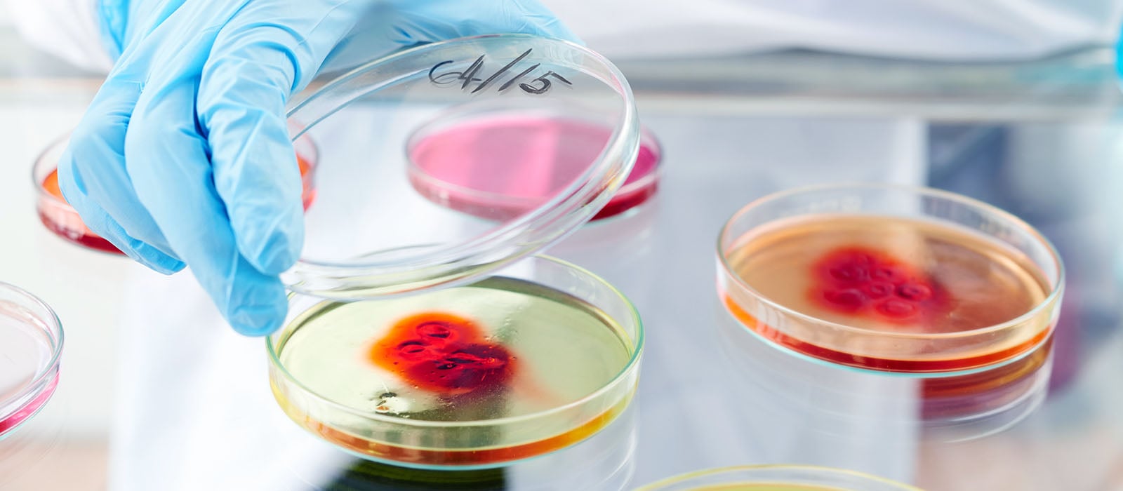 Cell Culture Contamination Control