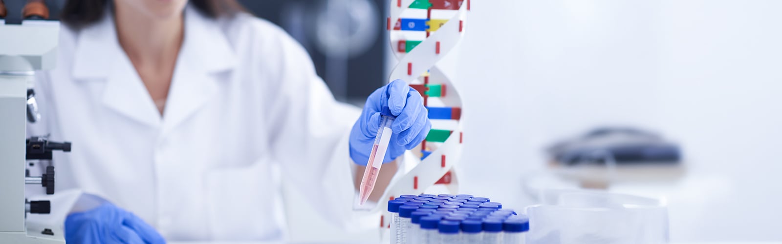 Histone Modification