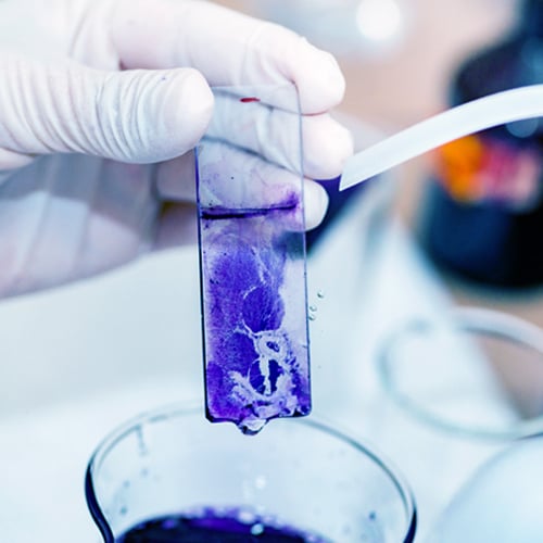 Antibiotic Sensitivity