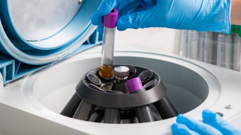 What To Consider Before Purchasing A Centrifuge