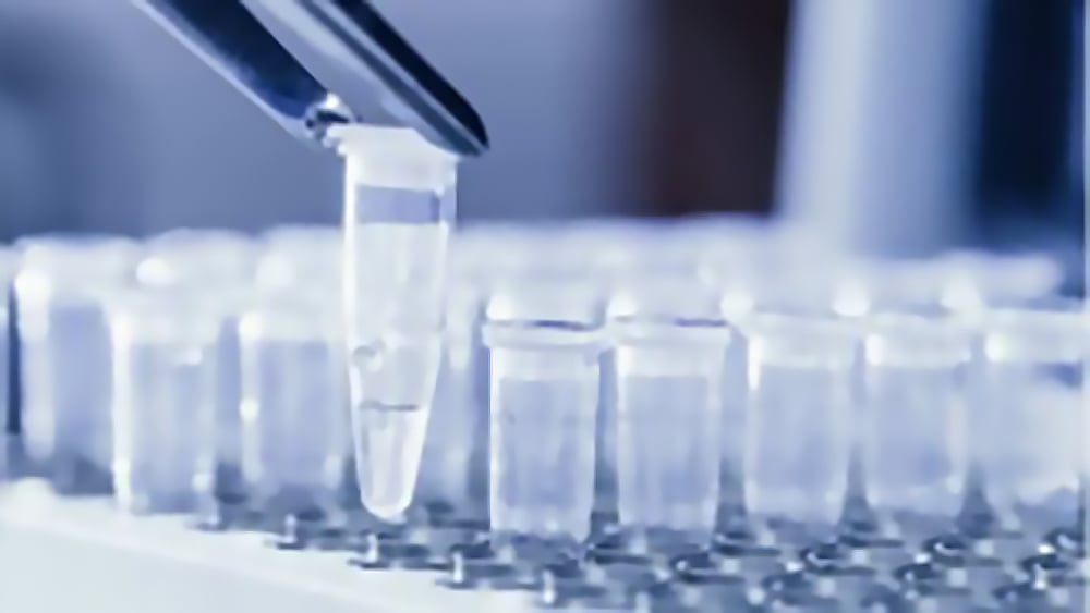 Cleaning Up PCR Samples